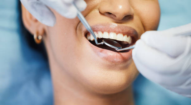 Best Emergency Root Canal Treatment in Eerlin, ND