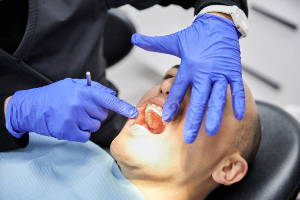 Best Emergency Tooth Extraction in Eerlin, ND
